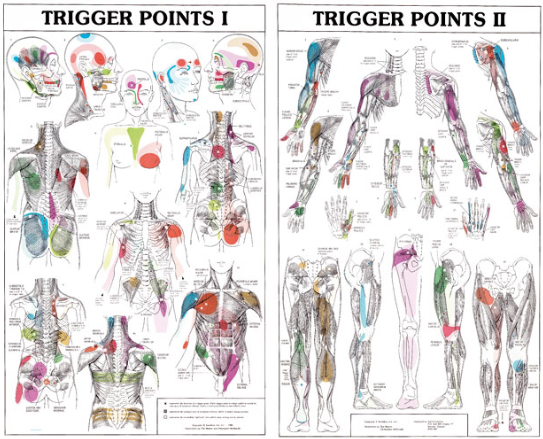 trigger points voor dry needling